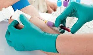 Cerca de sangue da vea do cóbado