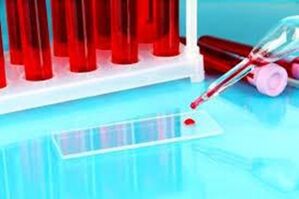 Hemoscania de sangue cae para parasitos