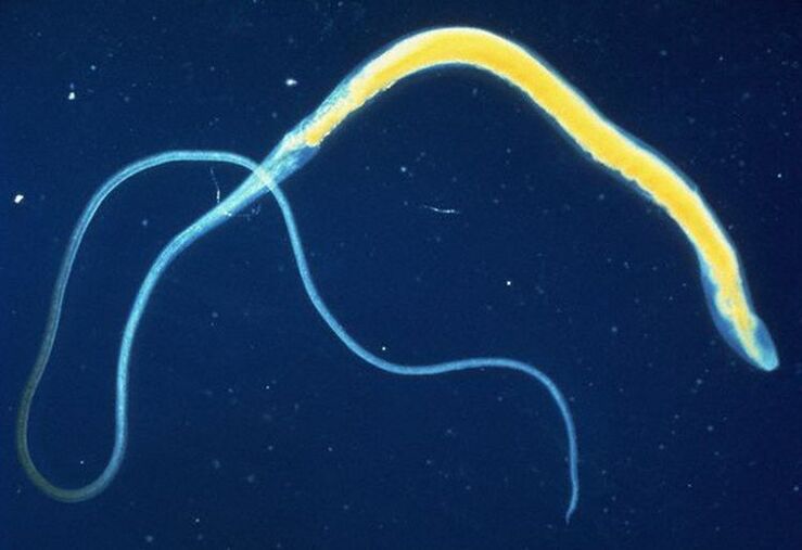 Whipworm é un parasito intestinal común.