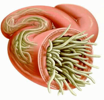 vermes vermellos no intestino humano